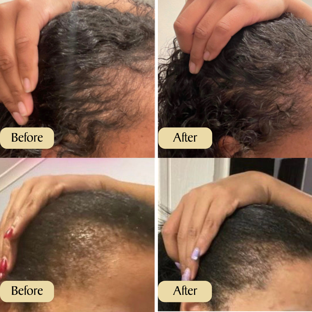 Veganic Hair Oil (FOR BUYING 1)