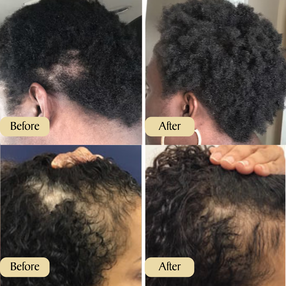Veganic Hair Oil (FOR BUYING 1)